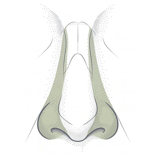 Ilustração anatômica — redução da base nasal, região abordada